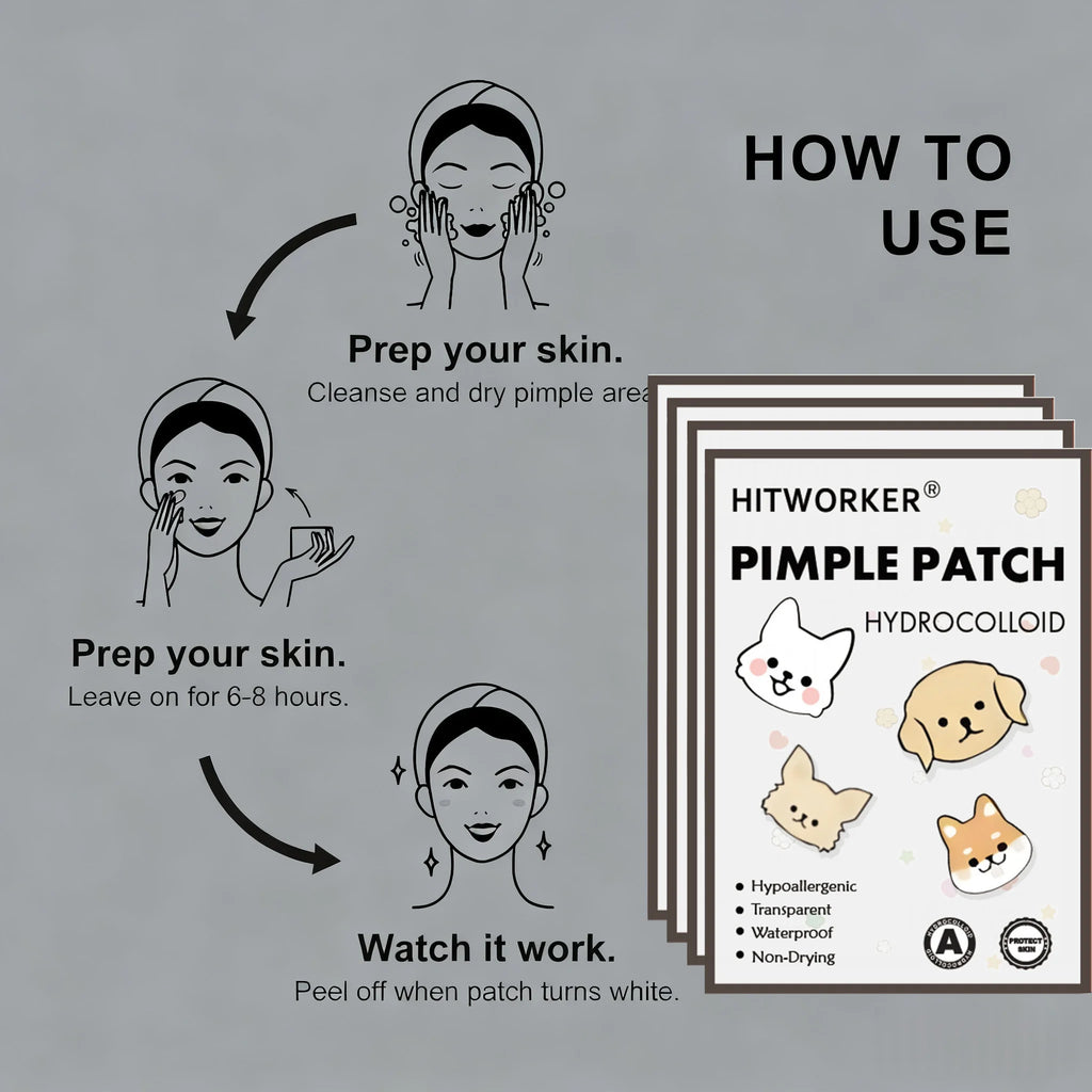 40/100/200 Pieces Hitworker Cartoon Dog Pimple Patches - Ultra-Thin, Breathable, Colorless & Odorless